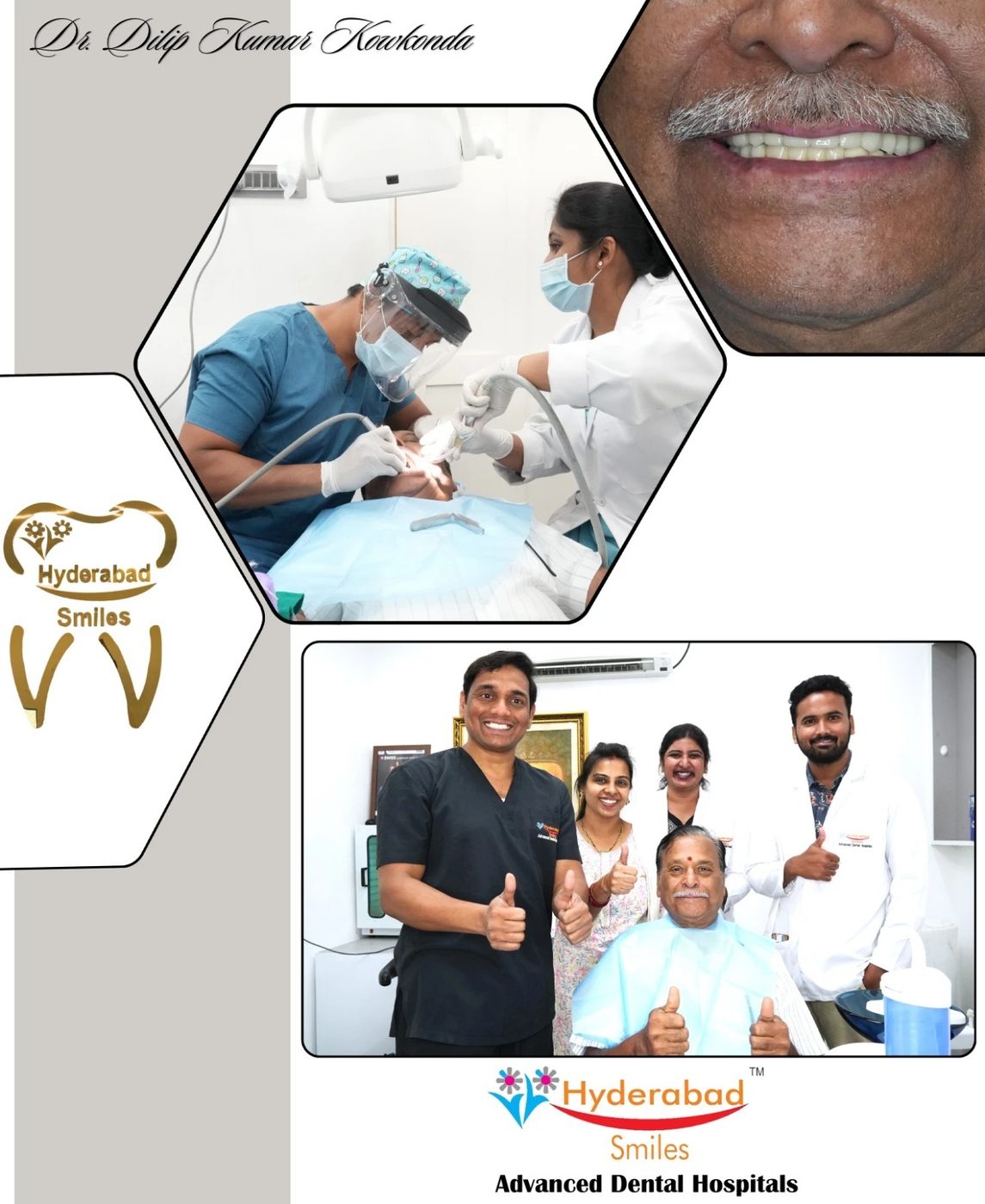 A full-mouth implant transformation by Dr. Dilip Kumar Kowkonda