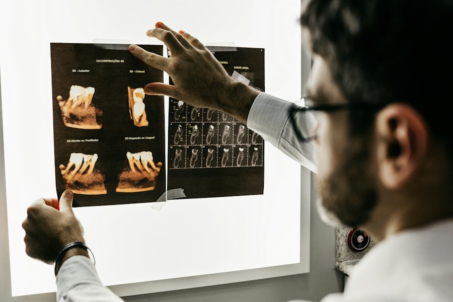 Dental implant planning with 3D dental scans